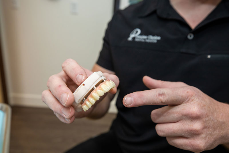 dental implant model mchenry fullarch