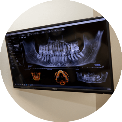 xray extraction mchenry