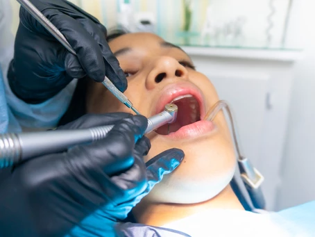 Oral Surgury Services in Bozeman: Tooth Extractions