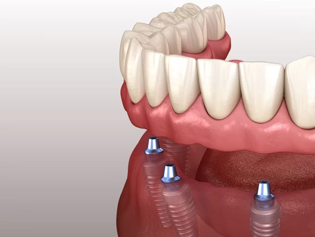 c4674a_73b1c3f4f2a04bafab6ecf21e061fd6e_mv2