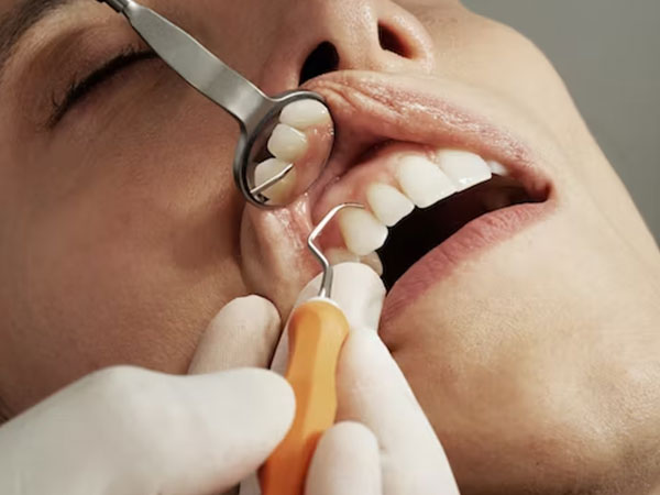 Dental Implants and Oral Health: Understanding the Connection