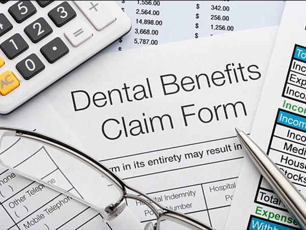 The Benefits of Choosing Dental Implants for Tooth Replacement